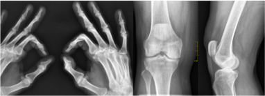 Diagnostica per immagini –                                                        Radiografie e RX domiciliare