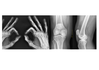 Diagnostica per immagini –                                                        Radiografie e RX domiciliare